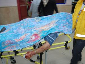 Nişanı bozan Kayınpederinin kulağını kesti