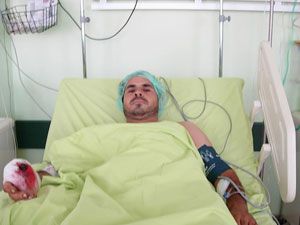 Kopan parmak yerine dikildi