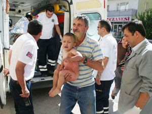 Süt kazanına düşen çocuk yaralandı