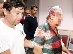 Parasını almaya gitti hastanelik oldu