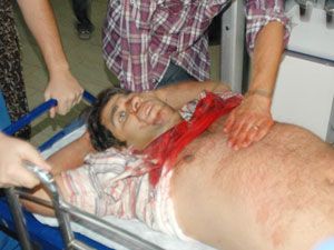 Kayınbiraderi tarafından bıçaklanan kişi öldü