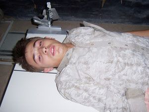 İki kazada, 2 kişi yaralandı