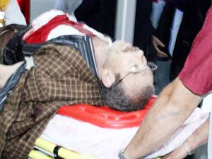 Oğlunu engellemeye çalışırken yaralandı