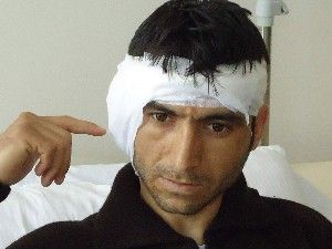 Doktorun kopardığı kulak yerine dikilemedi