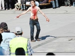 Bıçakla kendisine zarar verdi