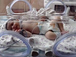 10 Günlük bebeğin kalbindeki damara stent takıldı