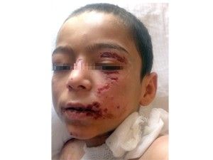 Üvey anne işkencesine maruz kaldığı iddiası