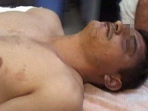 Yaralı halde 3 kilometre koşup canını kurtardı