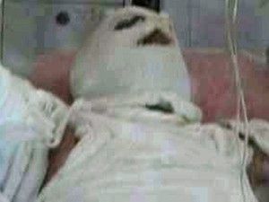 Hırsıza özel ambulans uçak