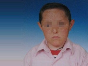 Zihinsel engelli çocuk, kaza kurbanı oldu