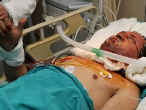 Yüz ve kol nakilleriyle başlayan tartışma