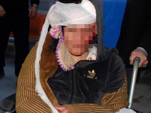 Kadınların kavgası hastanelik etti