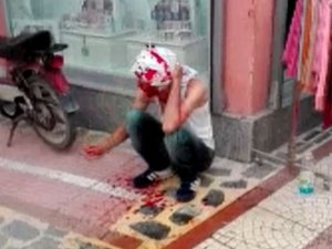 Kardeş Davulcuların Yer Kavgası Kanlı Bitti