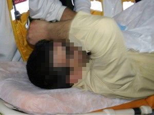 Komşuların çamaşır asma kavgası kanlı bitti