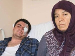 Maça gitti gözünü kaybetti