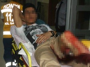 Kız arkadaşının ağabeyi tarafından bıçaklandı