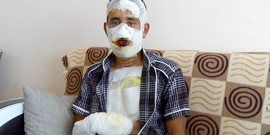 Konya'da askerin üzerine kolonya döküp yaktılar