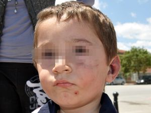 2 yaşındaki çocuk darp edildi iddiası
