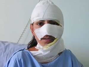 Yüzüne asit dökenleri tanımıyor