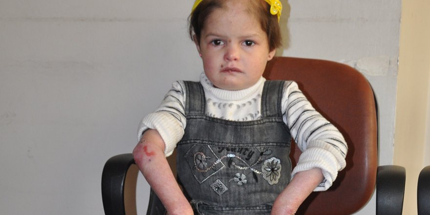 Suriyeli minik kız şifa bekliyor