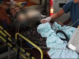 Yılan Yerine Babaannesini Öldürdü