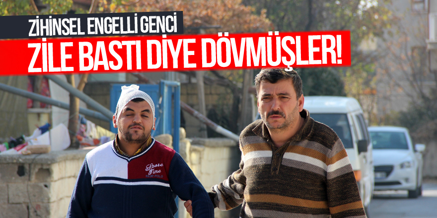 Zihinsel engelli genci zile bastı diye dövmüşler