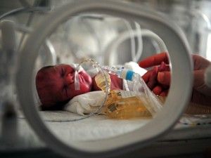 Bebekler kalp hastası doğuyor