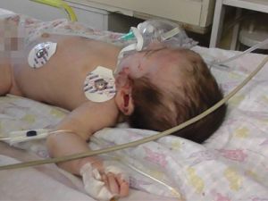 42 günlük bebeği ısırıp hastanelik etti