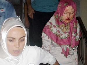 Dövüp kolundaki bilezikleri aldılar