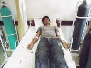 Elektrik akımına kapıldı