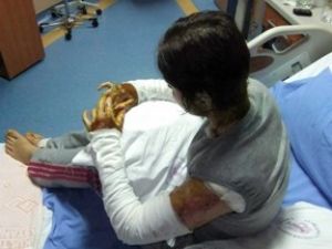 Üniversiteli genç kıza asitli saldırı