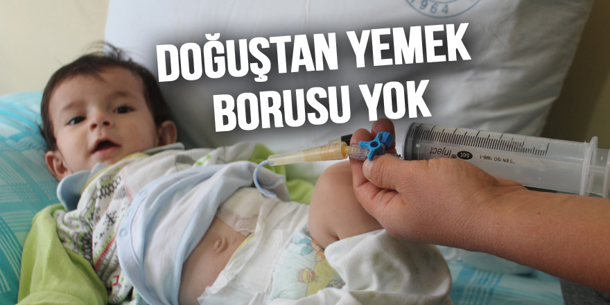 Doğuştan yemek borusu olmayan bebek yardım bekliyor