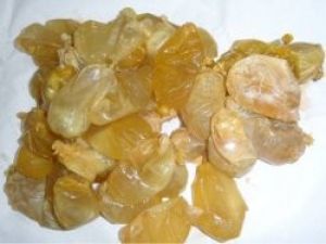 Bağırsaklarından 52 adet prezervatif çıktı