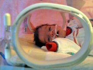Elif bebek karnı açık, organları dışarıda doğdu