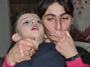 Yaşamaz dediler ama..