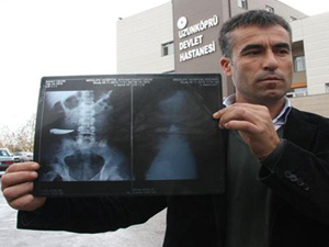 9 yıl karnında bakın neyle yaşamış