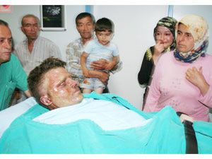 Baca temizlemek isterken yüzü yandı