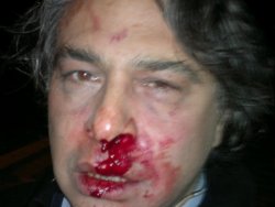 Barbaros Şansal saldırı anını anlattı
