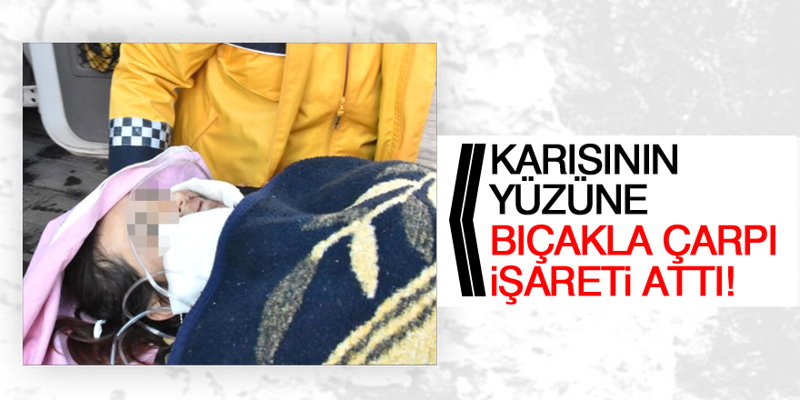 Tartıştığı eşini yüzünden bıçakladı