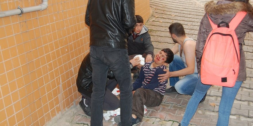 Kırılan sundurmadan aşağıya düşen çocuk yaralandı