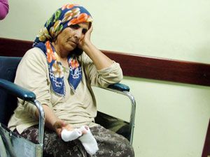 Anne ve oğlu ellerini yem makinesine kaptırdı