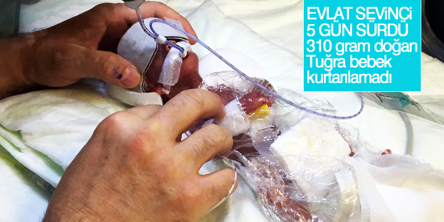 310 gram doğan Tuğra bebek kurtarılamadı