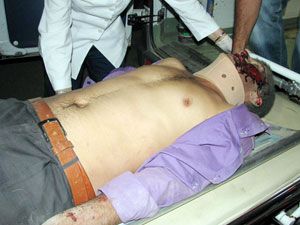 Kavgada yaralanan genci hastaneye götüren otomobil takla attı: 7 yaralı