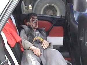 Bisikleti ikiye bölündü, yüzü parçalandı