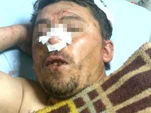 Hırsızı çırılçıplak sayup dövdüler