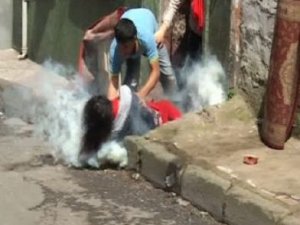 Genç kıza gaz bombası isabet etti!