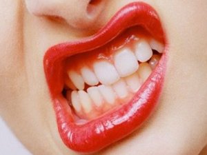 Diş gıcırdatma problemi nasıl aşılır?