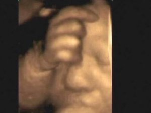 7 aylık bebeğin mucizevi görüntüleri