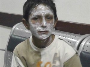 Benzin bidonunu ateşe veren çocuk yüzünü yaktı