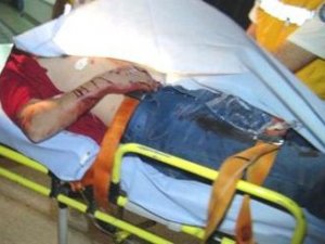 Otomobil tamiri için çağırıp, tüfekle vurdular